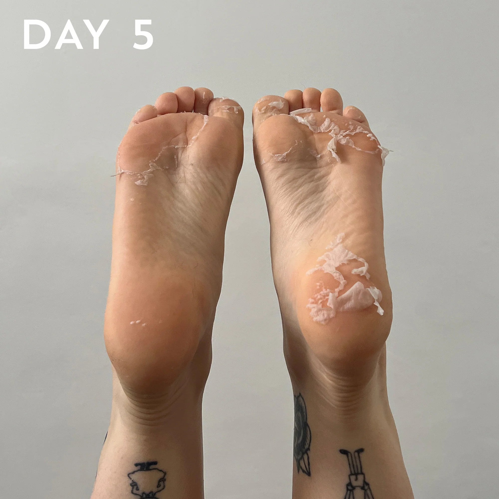 BEAUTYPRO Foot & Callus Peel Progress