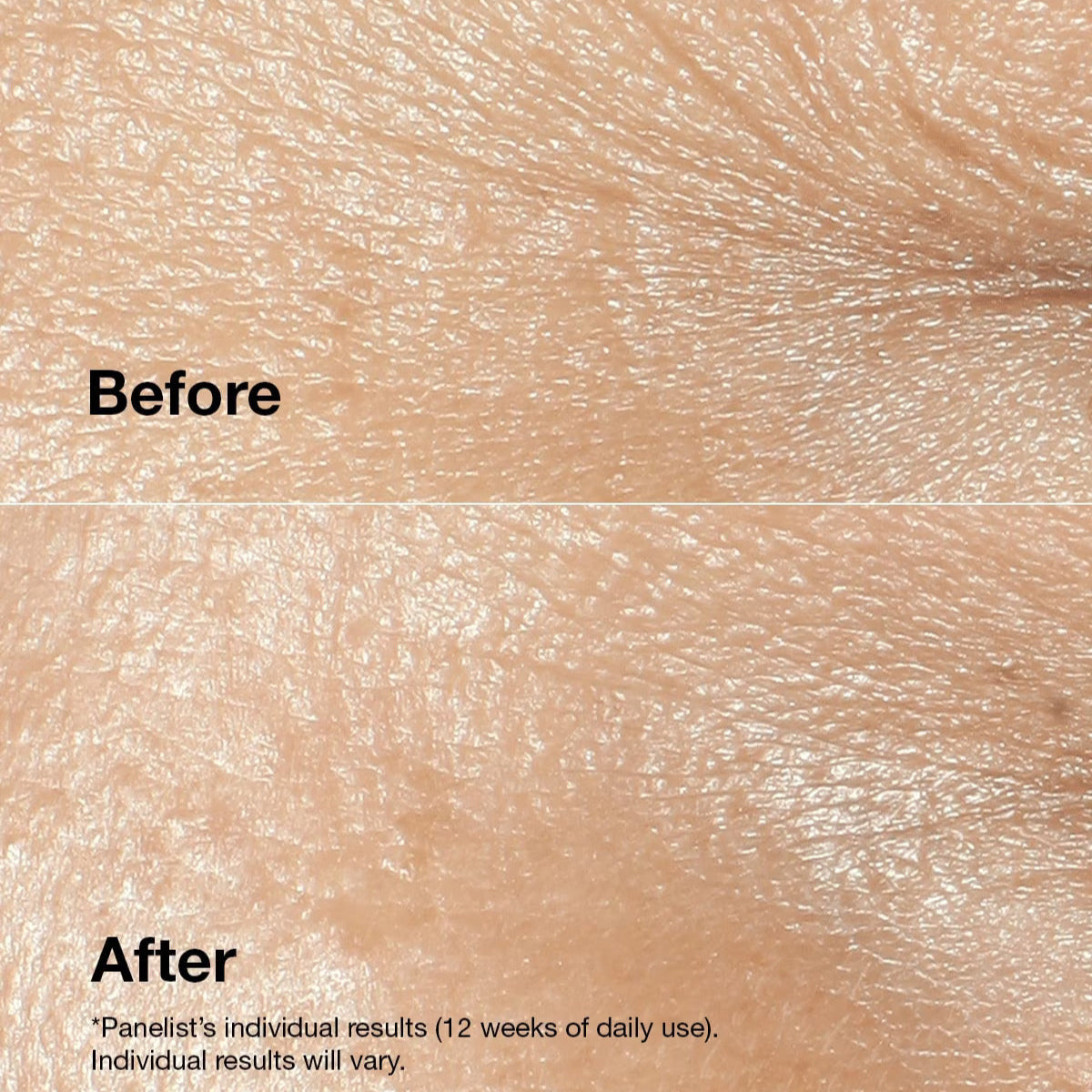 Clinique Smart Clinical Repair Wrinkle Correction Cream 50ml