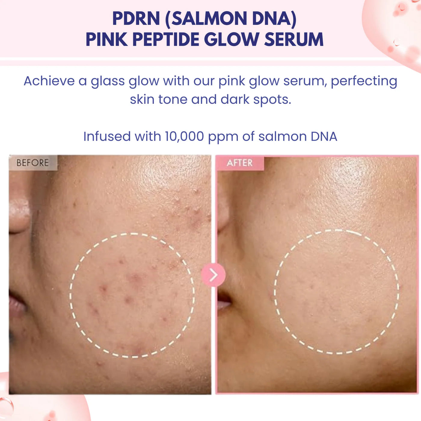 NARAE Pink Pdrn Gloss Serum 30ml results