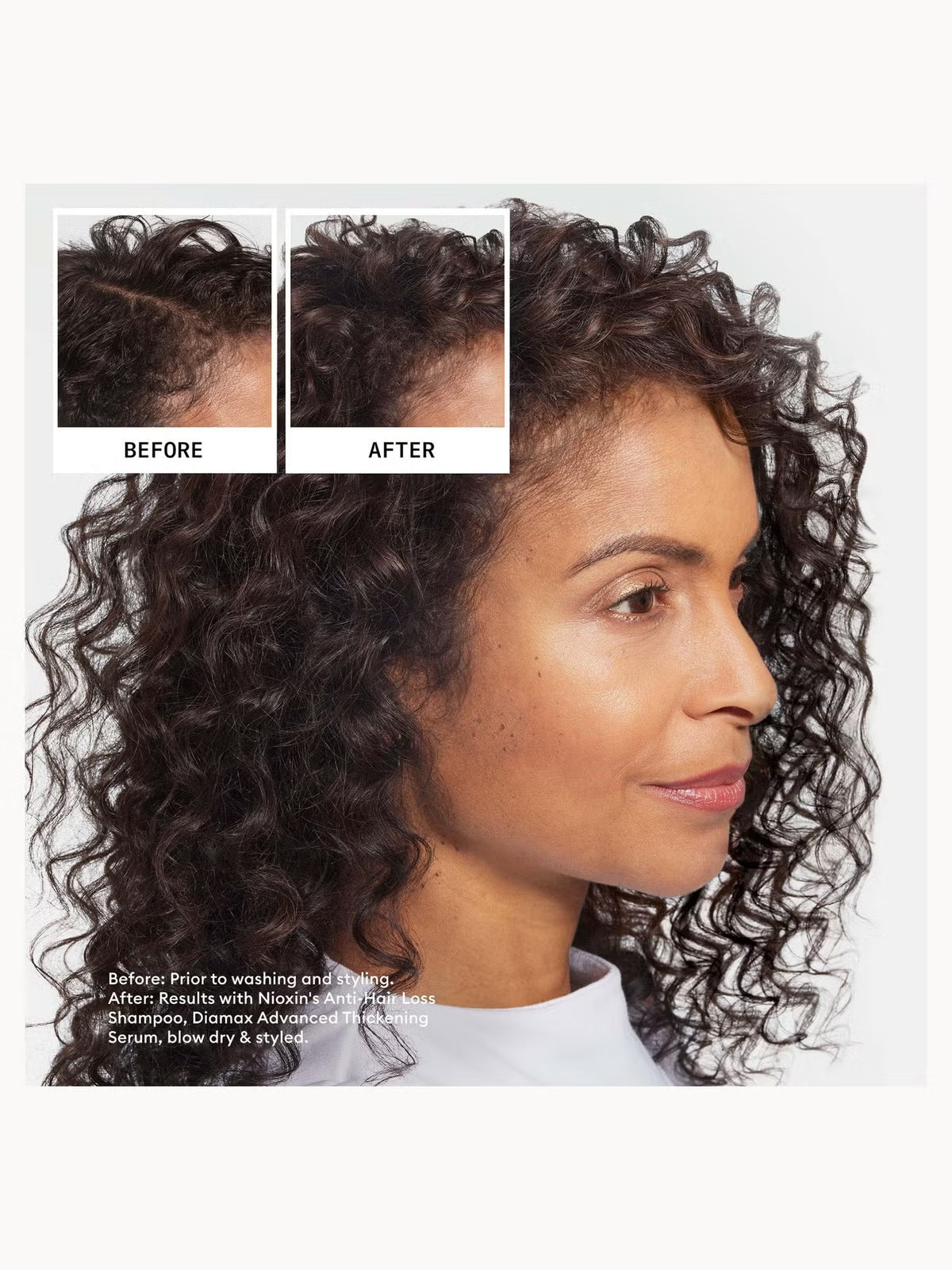 Nioxin Hair Fall Defense set