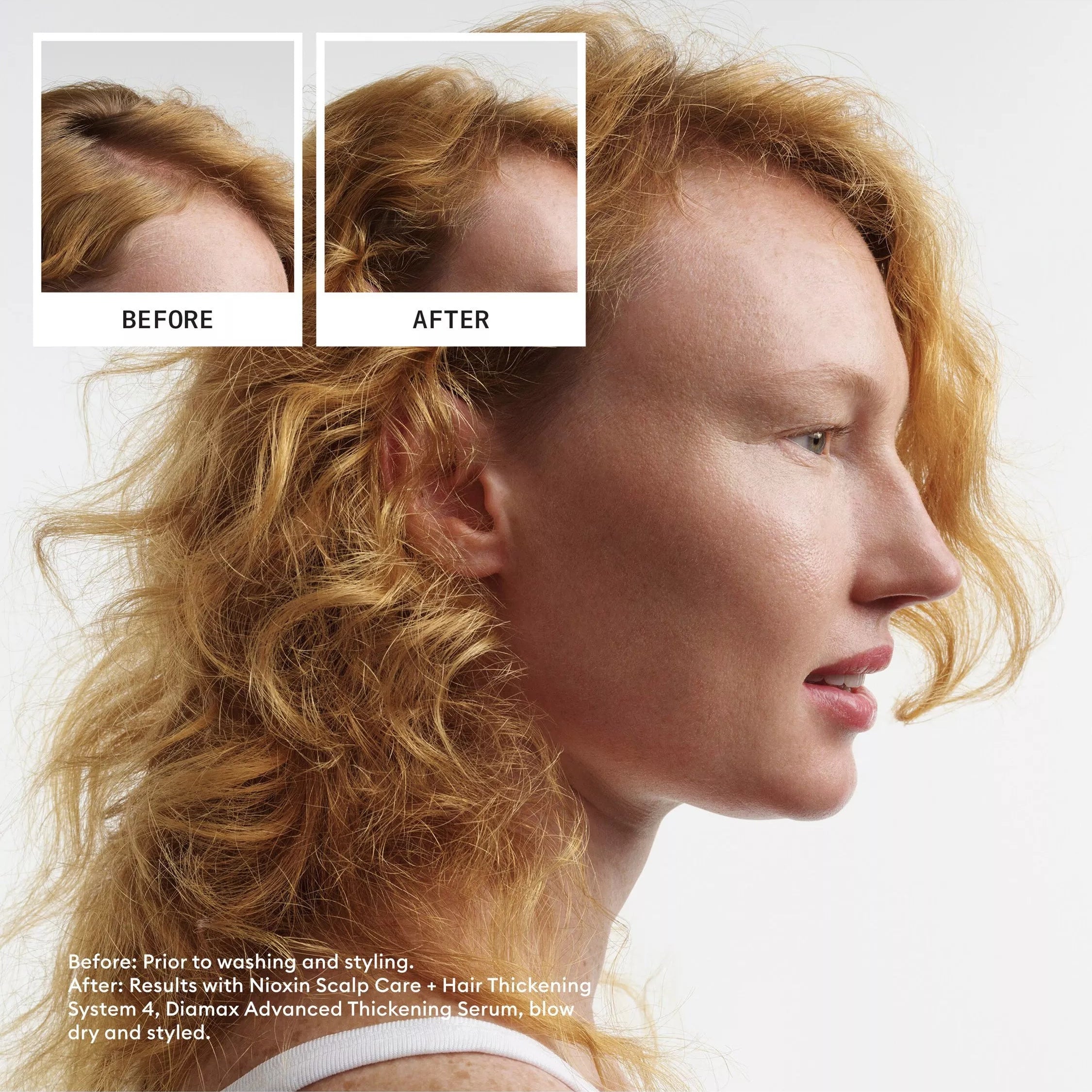 Nioxin System 4 kit