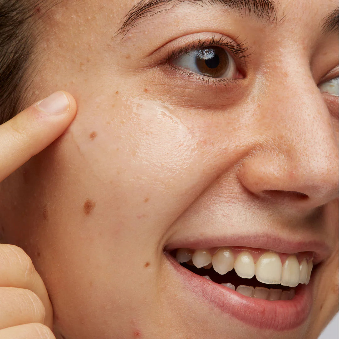 Bare Addiction Anti-Blemish Boost Serum 30ml