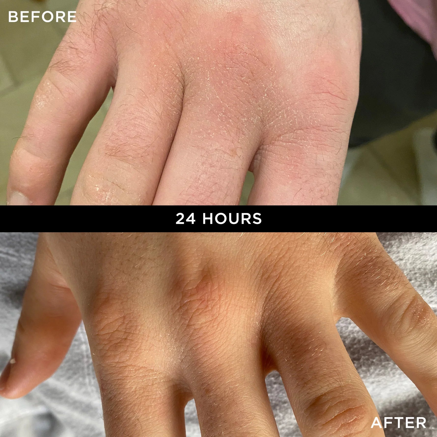 WONDERBALM 50ml BEFORE AND AFTER