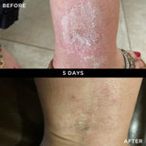 WONDERBALM 50ml BEFORE AND AFTER 1