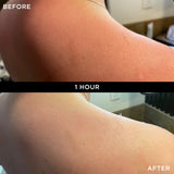 WONDERBALM 50ml BEFORE AND AFTER 2