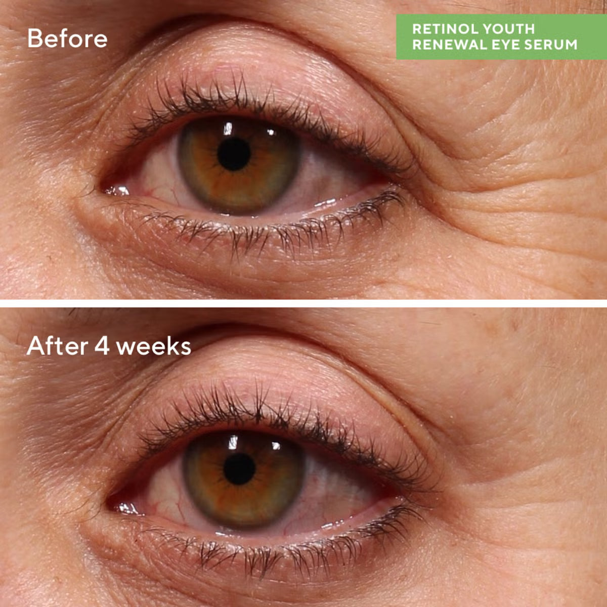 Murad Resurgence Retinol Youth Renewal Eye Serum 15ml