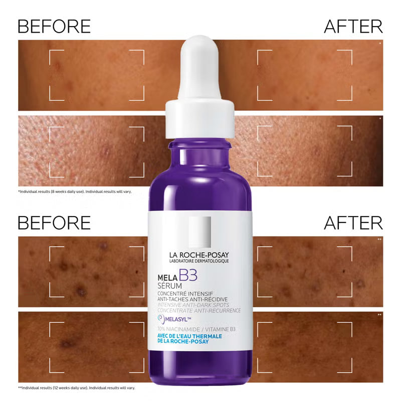La Roche-Posay Mela B3 Serum 30ml