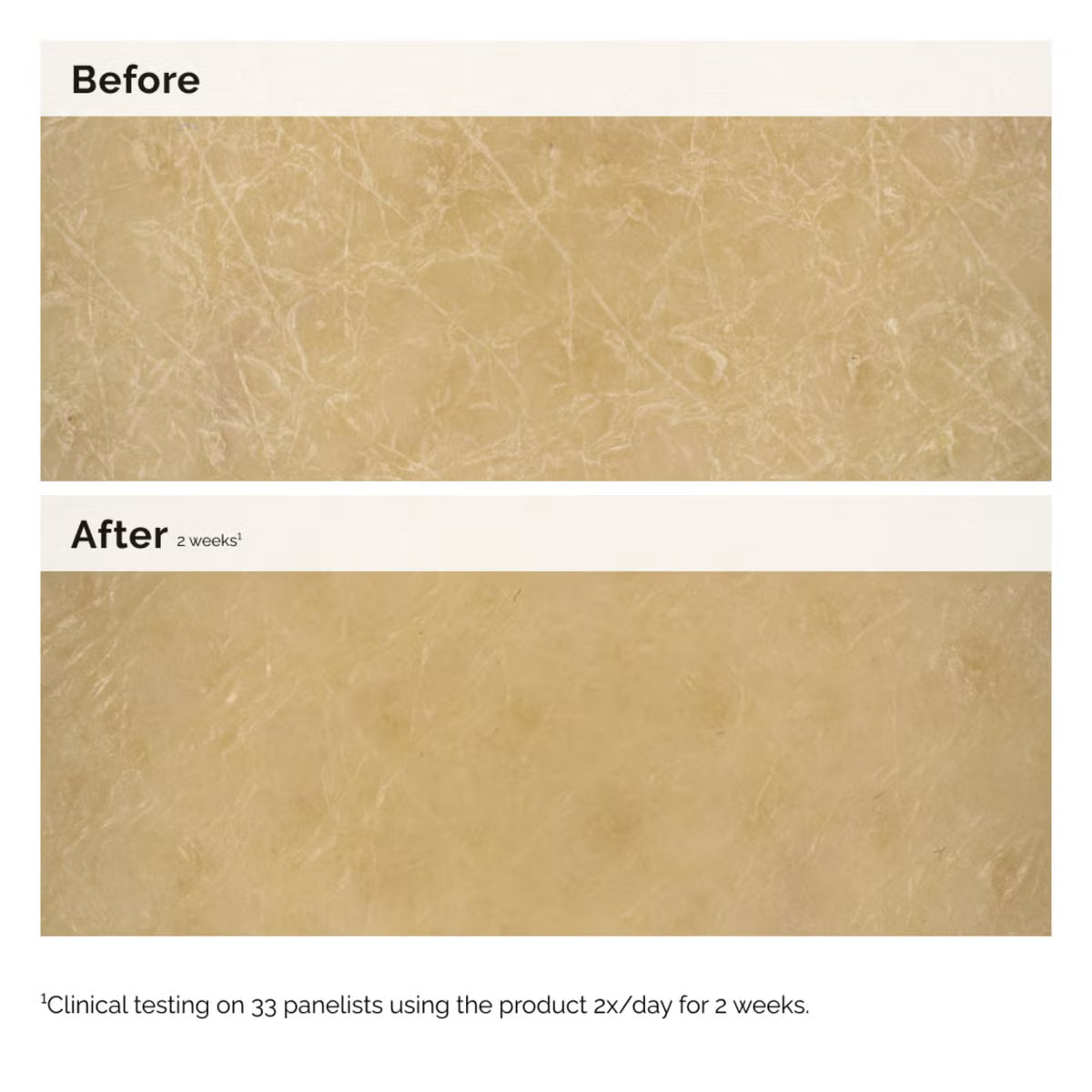 The Ordinary Natural Moisturizing Factors + Inulin Body Lotion 240ml