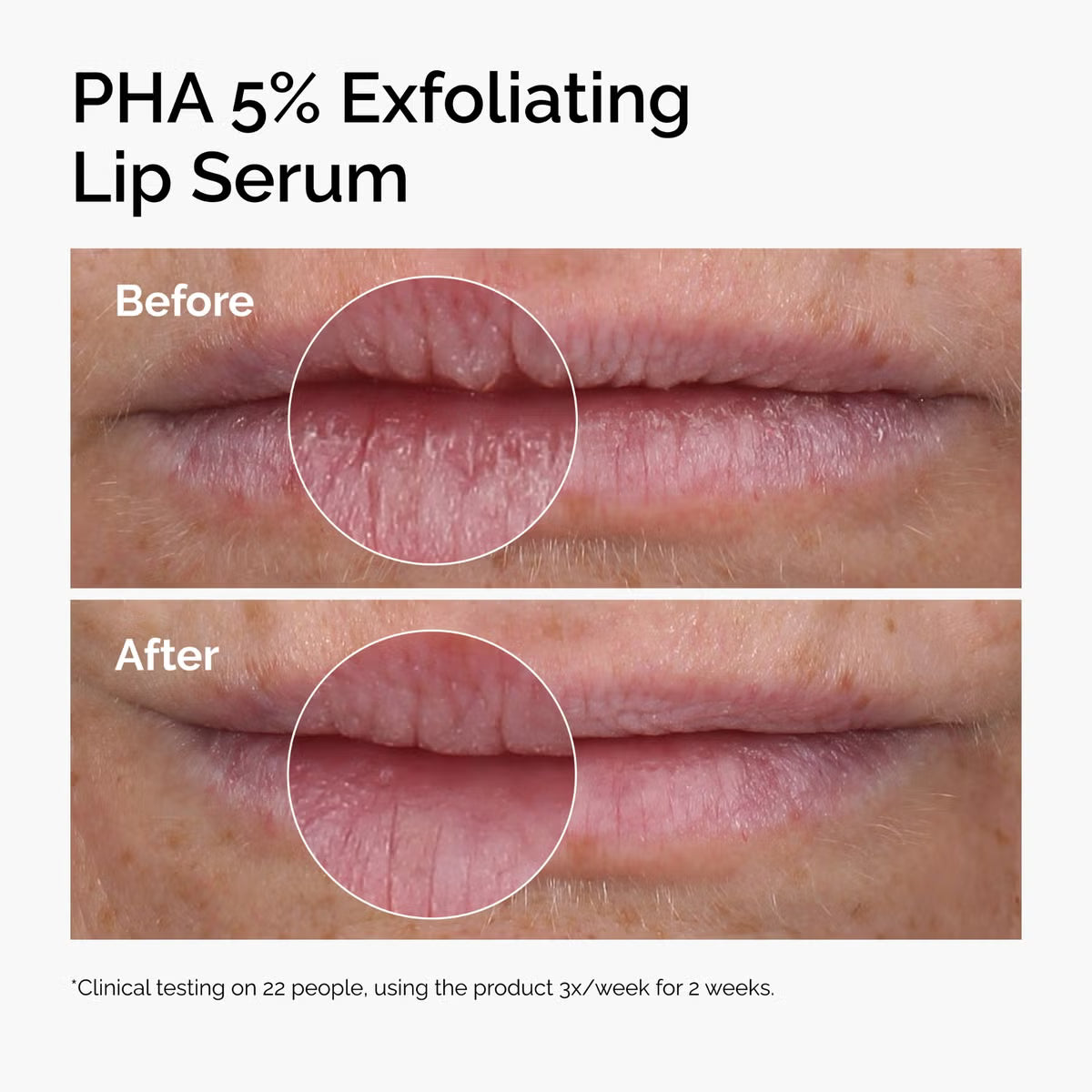 The Ordinary PHA 5% Exfoliating Lip Serum 15ml