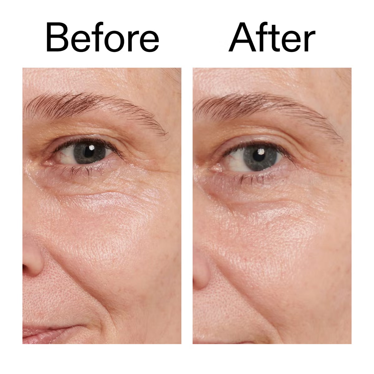 The Inkey List Retinol Eye Cream 15ml