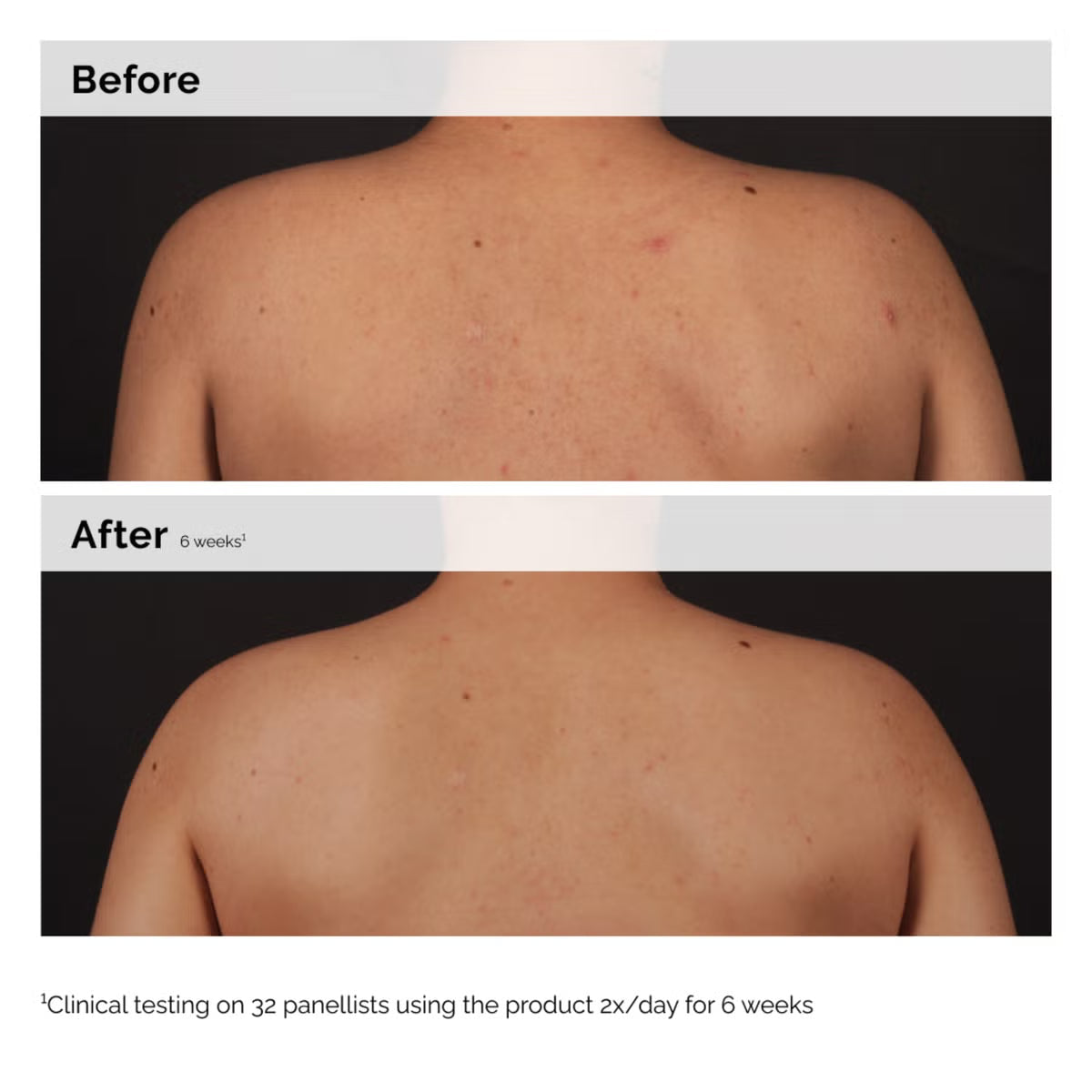 The Ordinary Salicylic Acid 0.5% Body Serum 240ml