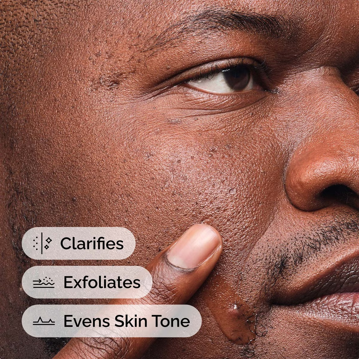 The Ordinary Salicylic Acid 2% Anhydrous Solution 30ml