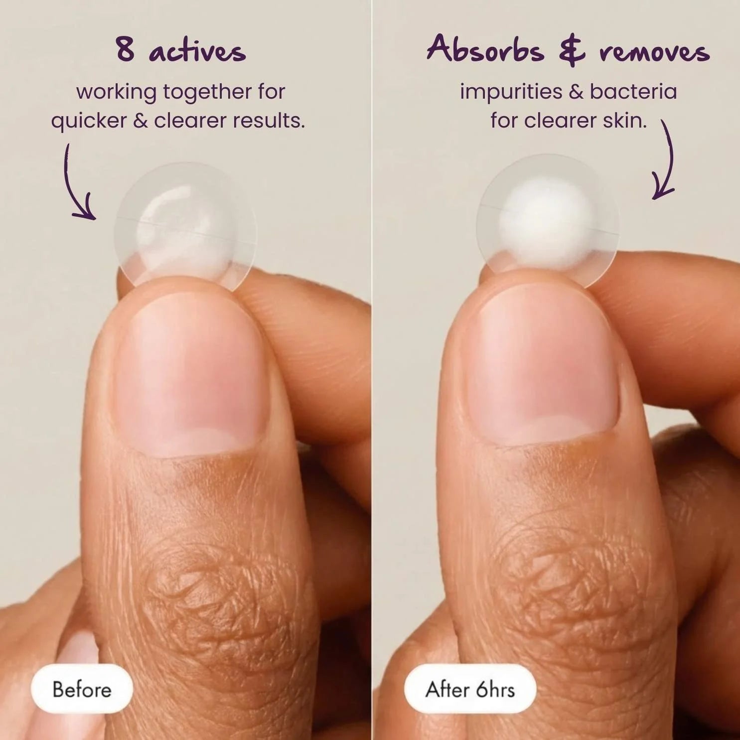 Bare Addiction Keep Calm & Patch On Pimple Patches