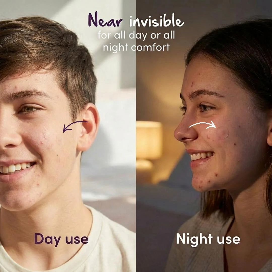 Bare Addiction Keep Calm & Patch On Pimple Patches