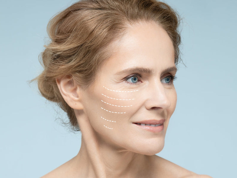 How to Reduce the Appearance of Fine Lines and Wrinkles