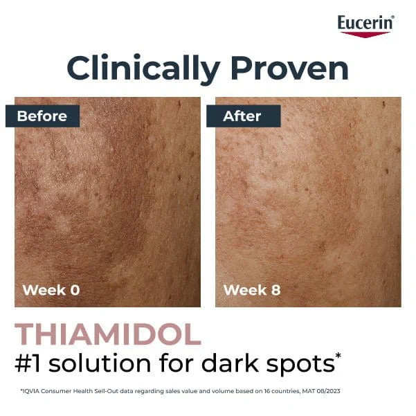 Eucerin Anti-Pigment Spot Corrector 5ml