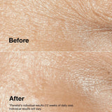 Clinique Smart Clinical Repair Wrinkle Correction Cream 50ml