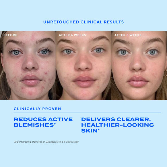 Murad Biome-Balancing Clear & Prevent Blemish Treatment Serum 30ml