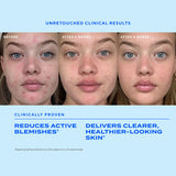 Murad Biome-Balancing Clear & Prevent Blemish Treatment Serum 30ml