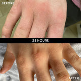 WONDERBALM 50ml BEFORE AND AFTER