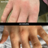WONDERBALM 50ml BEFORE AND AFTER