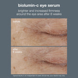 Dermalogica Biolumin-C Vitamin C Eye Serum 15ml