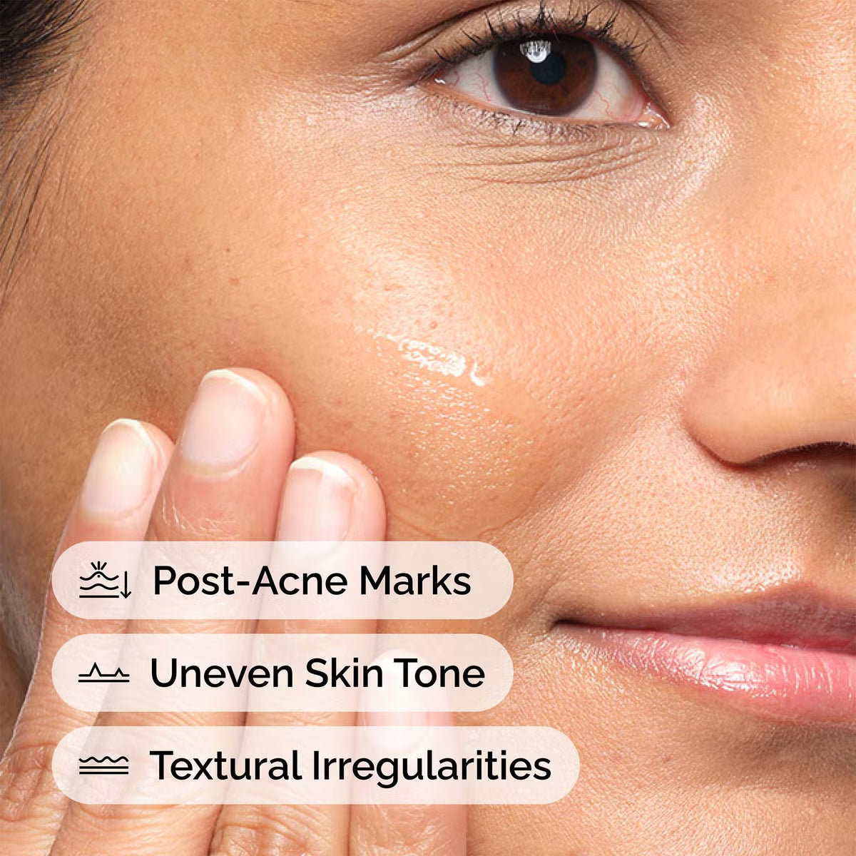 The Ordinary Aloe 2% + NAG 2% Solution 30ml