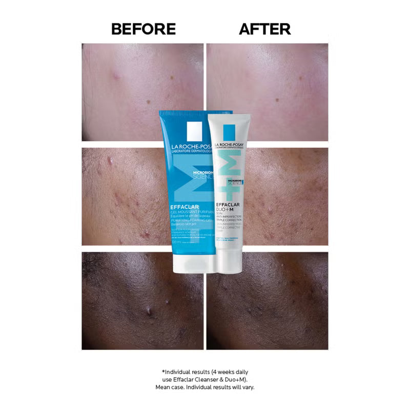 La Roche-Posay Effaclar Duo+M Anti-Blemish Corrective Gel Moisturiser 40ml