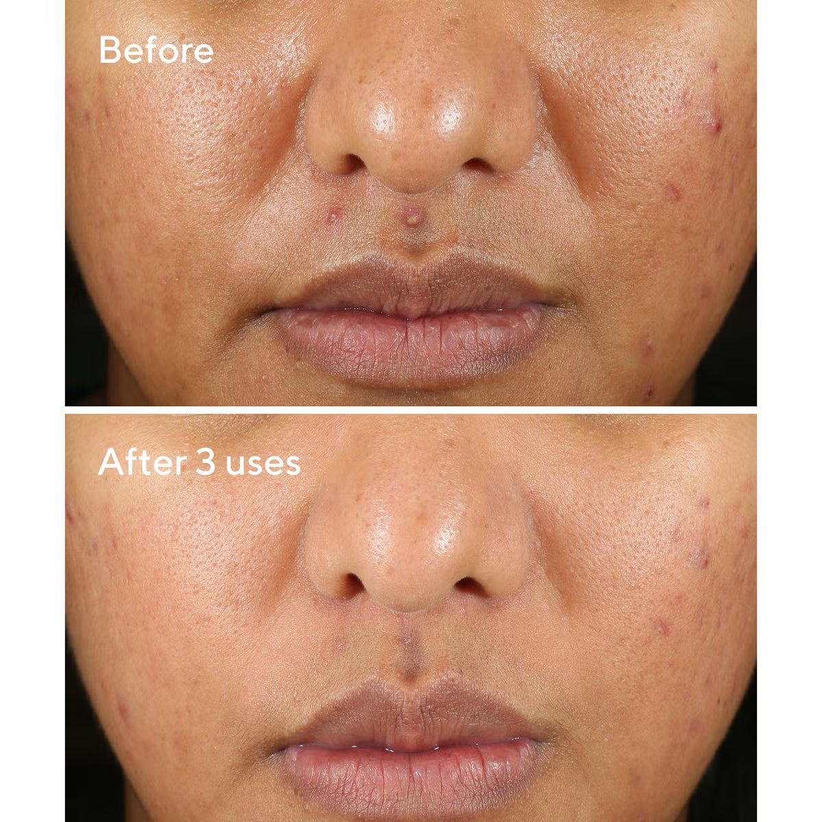 Murad Blemish Control Rapid Relief Sulfur Mask 74ml
