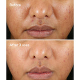 Murad Blemish Control Rapid Relief Sulfur Mask 74ml