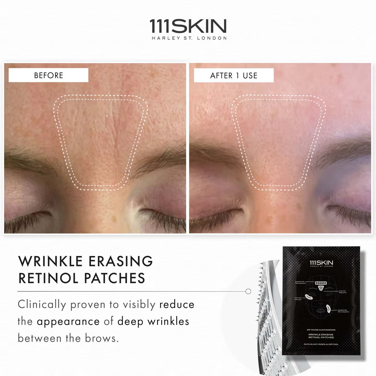 111Skin Wrinkle Erasing Retinol Patches 3 x 35g