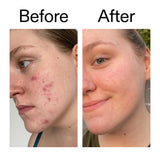 The Inkey List 15% Vitamin C and EGF Serum 30ml