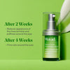 Murad Resurgence Retinol Youth Renewal Eye Serum 15ml