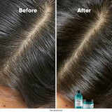 L'Oréal Professionnel Scalp Advanced Anti-Oiliness Dermo Purifier Shampoo 1500ml