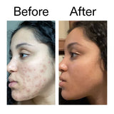 The Inkey List Tranexamic Acid Serum 30ml