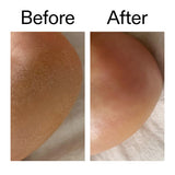 The Inkey List Glycolic Acid Exfoliating Body Stick 45g