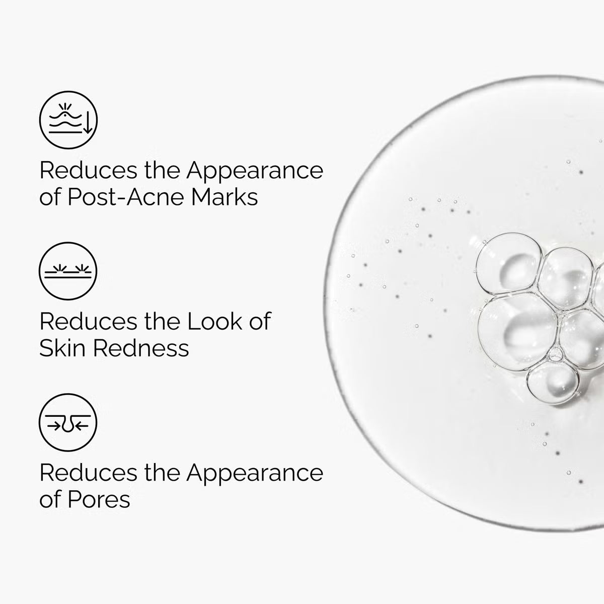 The Ordinary Aloe 2% + NAG 2% Solution 30ml